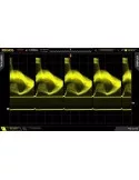 RIGOL DS2072A-S